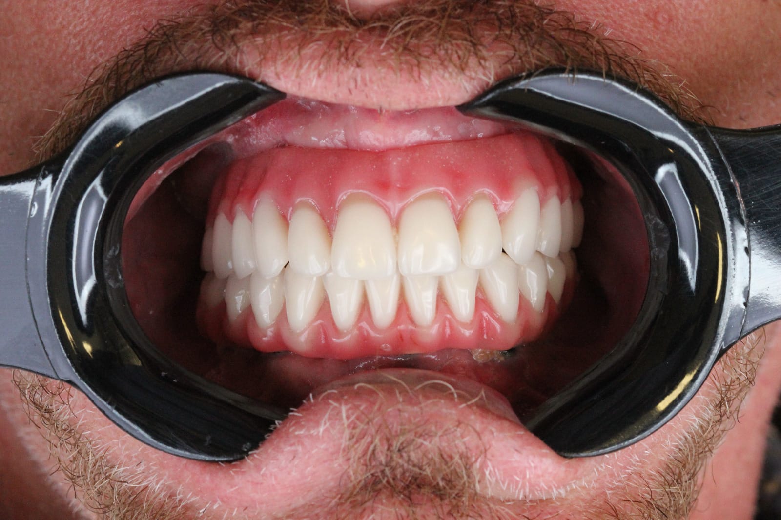 Resultado após o tratamento odontológico