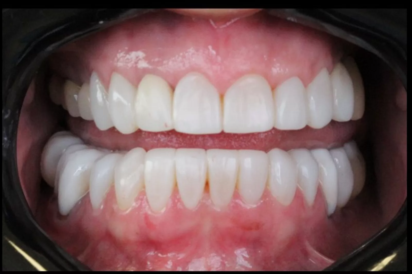 Resultado após o tratamento odontológico